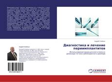 Buchcover von Диагностика и лечение периимплантитов