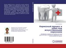 Buchcover von Кариозный процесс в зубах под искусственными коронками