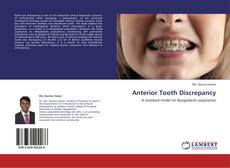 Bookcover of Anterior Tooth Discrepancy