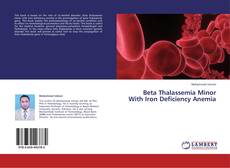 Buchcover von Beta Thalassemia Minor With Iron Deficiency Anemia