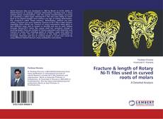 Buchcover von Fracture & length of Rotary Ni-Ti files used in curved roots of molars