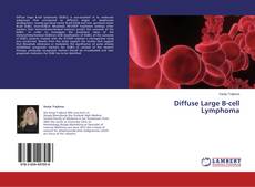 Buchcover von Diffuse Large B-cell Lymphoma