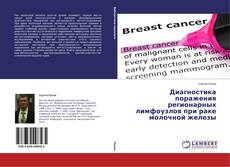 Couverture de Диагностика поражения регионарных лимфоузлов при раке молочной железы