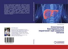 Couverture de Спонтанный бактериальный перитонит при циррозе печени
