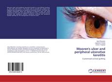 Copertina di Mooren's ulcer and peripheral ulcerative keratitis