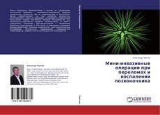 Buchcover von Мини-инвазивные операции при переломах и воспалении позвоночника