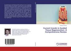 Current trends in Guided Tissue Regeneration: A Comprehensive Review的封面