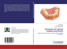 Copertina di Occlusion for dental implant prosthesis