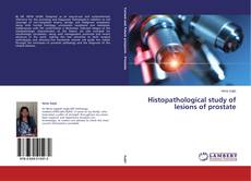 Buchcover von Histopathological study of lesions of prostate