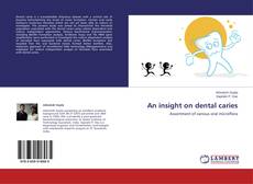 Couverture de An insight on dental caries
