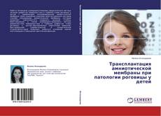 Buchcover von Трансплантация амниотической мембраны при патологии роговицы у детей