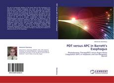Couverture de PDT versus APC in Barrett’s Esophagus
