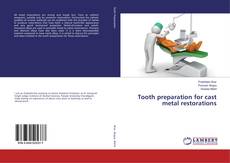 Bookcover of Tooth preparation for cast metal restorations