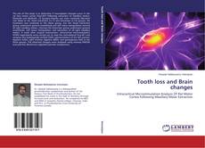 Tooth loss and Brain changes的封面