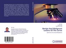 Buchcover von Benign And Malignant Lesions Of The Cervix