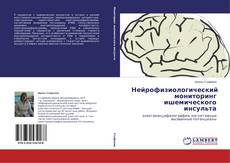 Buchcover von Нейрофизиологический мониторинг ишемического инсульта