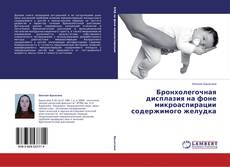 Buchcover von Бронхолегочная дисплазия на фоне микроаспирации содержимого желудка