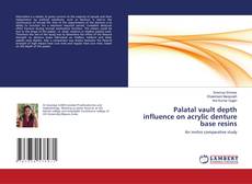 Buchcover von Palatal vault depth influence on acrylic denture base resins
