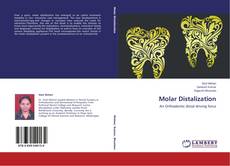 Buchcover von Molar Distalization