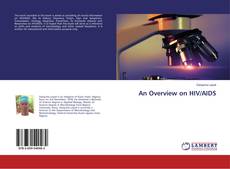 Buchcover von An Overview on HIV/AIDS
