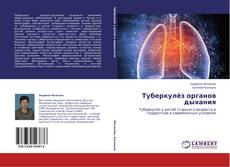 Buchcover von Туберкулёз органов дыхания