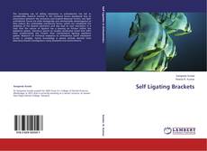 Buchcover von Self Ligating Brackets