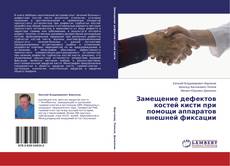 Copertina di Замещение дефектов костей кисти при помощи аппаратов внешней фиксации