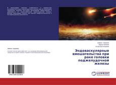 Buchcover von Эндоваскулярные вмешательства при раке головки поджелудочной железы