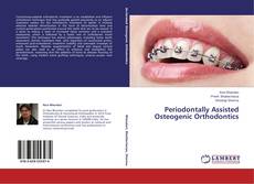 Capa do livro de Periodontally Assisted Osteogenic Orthodontics 