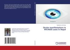 Capa do livro de Ocular manifestations in HIV/AIDS cases in Nepal 