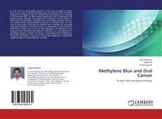 Buchcover von Methylene Blue and Oral Cancer
