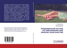 Bookcover of Современный взгляд на заболевания вен нижних конечностей
