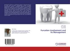Обложка Furcation Involvement and Its Management