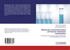 Copertina di Molecular characterization of Panton Valentine leukocidine