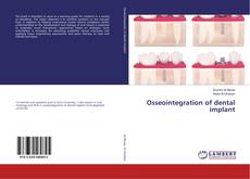 Buchcover von Osseointegration of dental implant