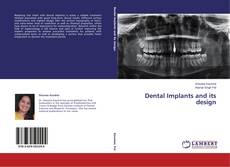 Dental Implants and its design的封面