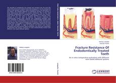 Buchcover von Fracture Resistance Of Endodontically Treated Teeth