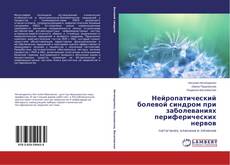 Capa do livro de Нейропатический болевой синдром при заболеваниях периферических нервов 