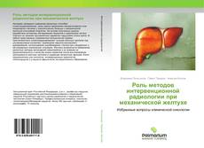 Buchcover von Роль методов интервенционной радиологии при механической желтухе