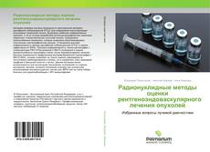 Borítókép a  Радионуклидные методы оценки рентгеноэндоваскулярного лечения опухолей - hoz