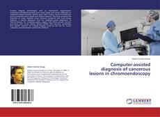 Computer-assisted diagnosis of cancerous lesions in chromoendoscopy的封面