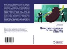 Capa do livro de Метастатический рак почки: факторы прогноза 
