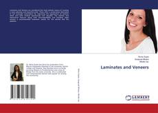 Bookcover of Laminates and Veneers