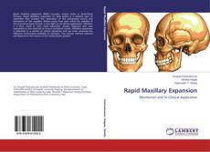 Bookcover of Rapid Maxillary Expansion