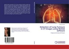 Buchcover von Detection of Lung Tumours in CT Images using Matlab software