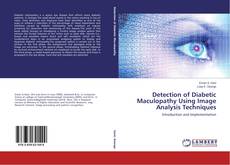 Bookcover of Detection of Diabetic Maculopathy Using Image Analysis Techniques
