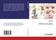 Buchcover von Cleft lip and palate