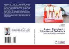 Bookcover of Implant Biomechanics: Principles and Applications