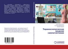Buchcover von Торакоскопическая грудная симпатэктомия