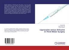 Обложка Lignocaine versus Articaine in Third Molar Surgery